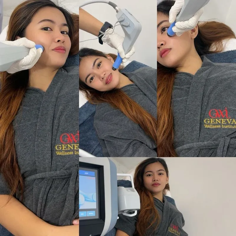 Exilis Face and Neck